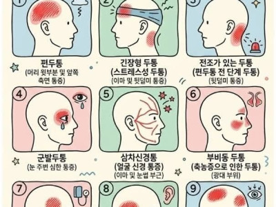 머리 통증 위치로 알아보는 9가지 두통 종류